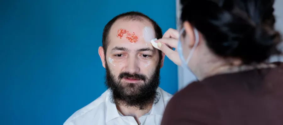 Scar (Surgery, Acne, Wound) Treatment