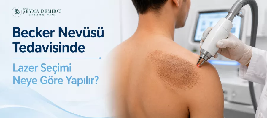 Becker Nevüsü Tedavisinde Lazer Seçimi Neye Göre Yapılır? 1 Becker Nevüsü Tedavisinde Lazer Seçimi Neye Göre Yapılır?